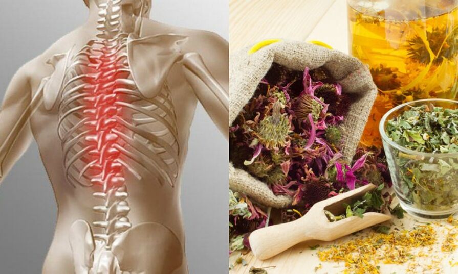 Traditional recipes prevent the development of osteochondrosis and support the health of the spine