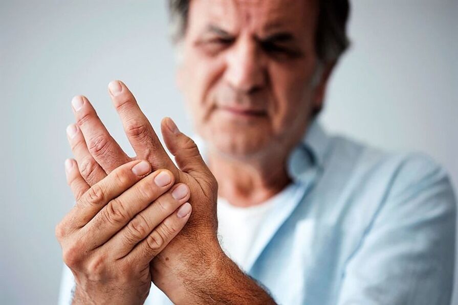 signs of arthritis of the hand