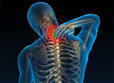 Neck pain is a common symptom of osteochondosis